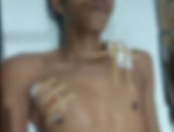 Memergoki Aksi Pencuri di Rumahnya Sendiri, Seorang Pemuda Ditusuk Pisau oleh Pelaku